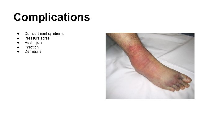 Complications ● ● ● Compartment syndrome Pressure sores Heat injury Infection Dermatitis 