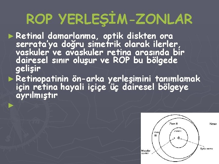 ROP YERLEŞİM-ZONLAR ► Retinal damarlanma, optik diskten ora serrata’ya doğru simetrik olarak ilerler, vaskuler