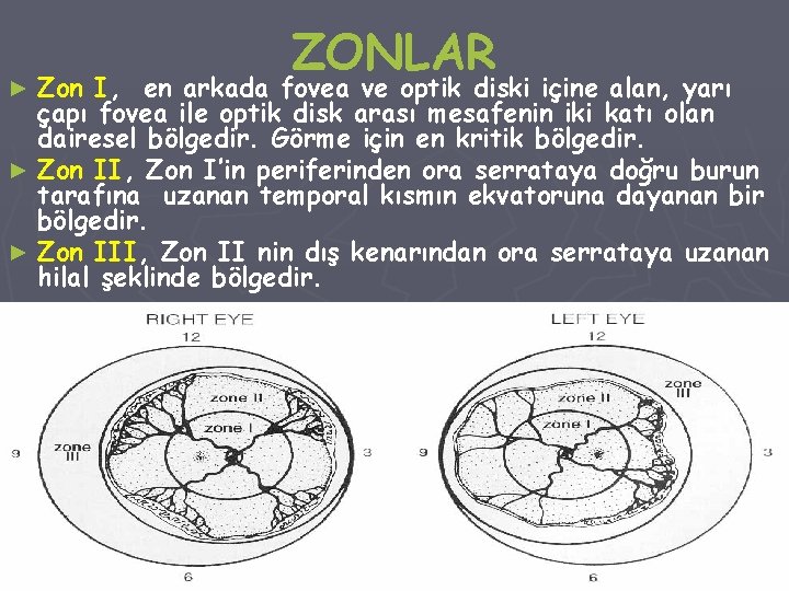 ZONLAR Zon I, en arkada fovea ve optik diski içine alan, yarı çapı fovea