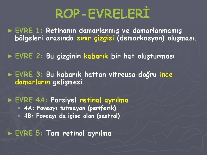 ROP-EVRELERİ ► EVRE 1: Retinanın damarlanmış ve damarlanmamış bölgeleri arasında sınır çizgisi (demarkasyon) oluşması.