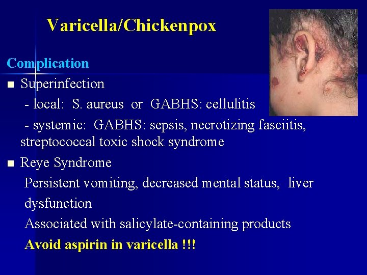 Varicella/Chickenpox Complication n Superinfection - local: S. aureus or GABHS: cellulitis - systemic: GABHS: