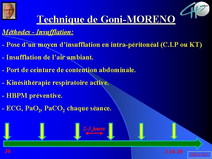 Technique de Goni-MORENO Méthodes - Insufflation: - Pose d’un moyen d’insufflation en intra-péritonéal (C.