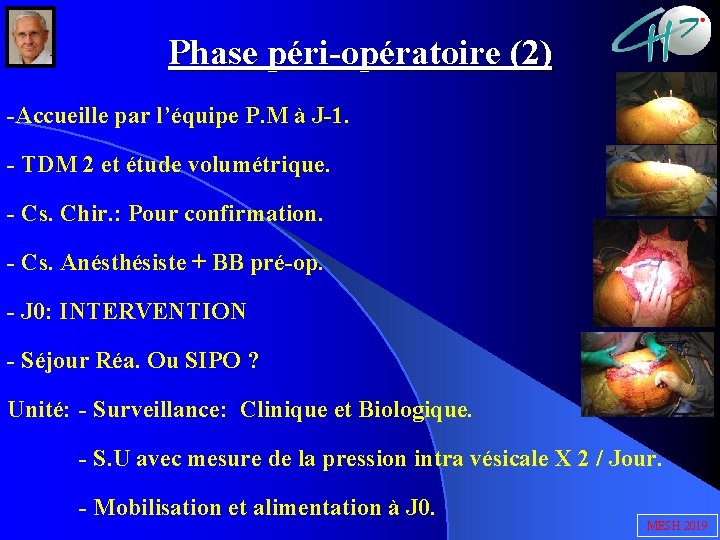 Phase péri-opératoire (2) -Accueille par l’équipe P. M à J-1. - TDM 2 et