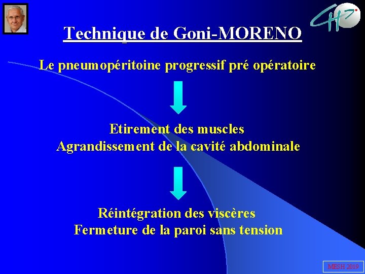Technique de Goni-MORENO Le pneumopéritoine progressif pré opératoire Etirement des muscles Agrandissement de la