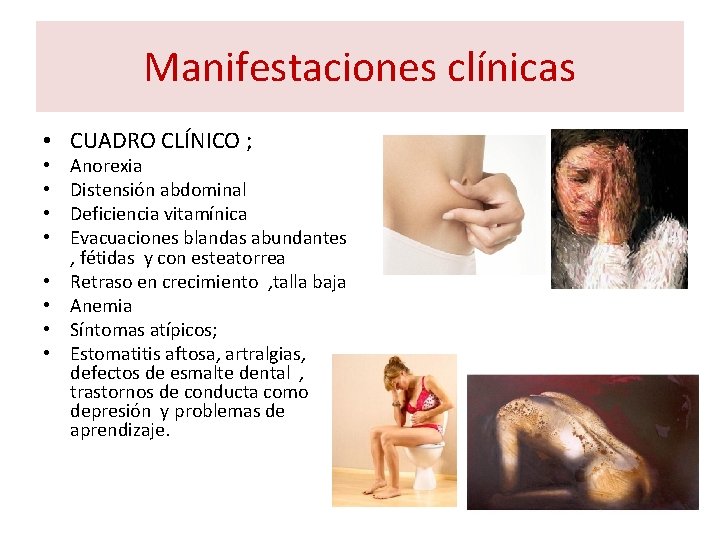 Manifestaciones clínicas • CUADRO CLÍNICO ; • • Anorexia Distensión abdominal Deficiencia vitamínica Evacuaciones Manifestaciones clínicas • CUADRO CLÍNICO ; • • Anorexia Distensión abdominal Deficiencia vitamínica Evacuaciones
