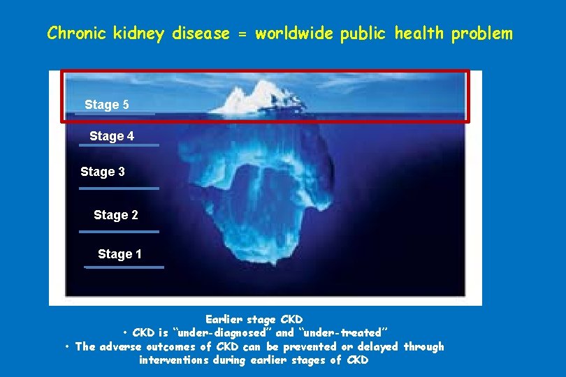 Chronic kidney disease = worldwide public health problem Stage 5 Stage 4 Stage 3