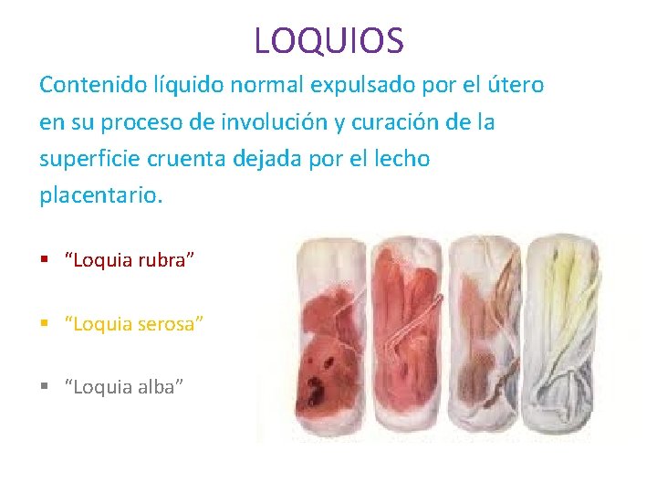 LOQUIOS Contenido líquido normal expulsado por el útero en su proceso de involución y LOQUIOS Contenido líquido normal expulsado por el útero en su proceso de involución y