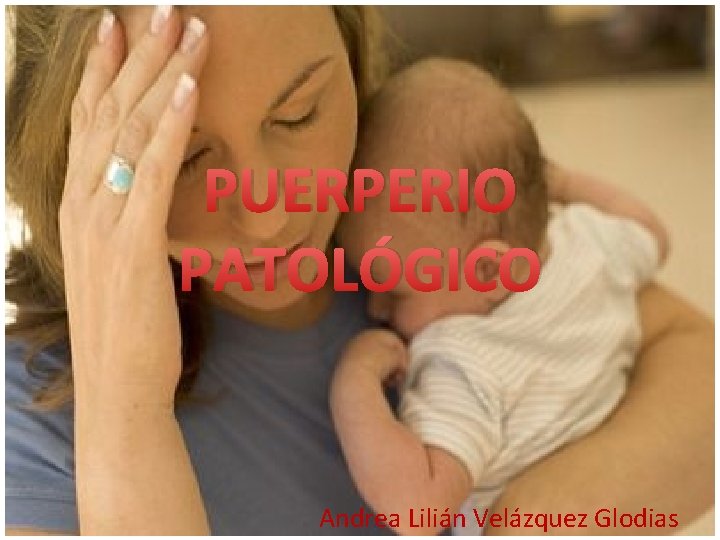 PUERPERIO PATOLÓGICO Andrea Lilián Velázquez Glodias PUERPERIO PATOLÓGICO Andrea Lilián Velázquez Glodias