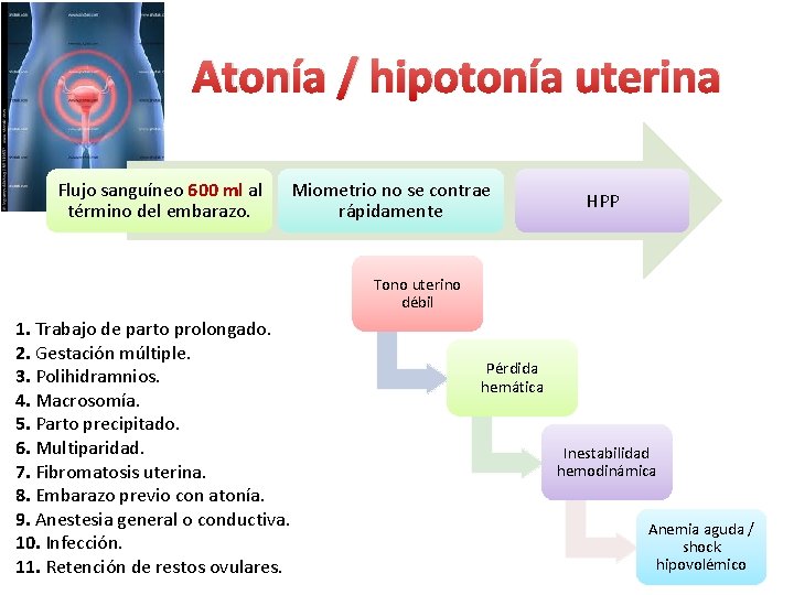Atonía / hipotonía uterina Flujo sanguíneo 600 ml al término del embarazo. Miometrio no Atonía / hipotonía uterina Flujo sanguíneo 600 ml al término del embarazo. Miometrio no