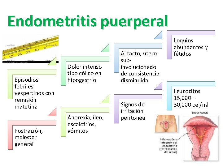 Endometritis puerperal Episodios febriles vespertinos con remisión matutina Postración, malestar general Dolor intenso tipo Endometritis puerperal Episodios febriles vespertinos con remisión matutina Postración, malestar general Dolor intenso tipo