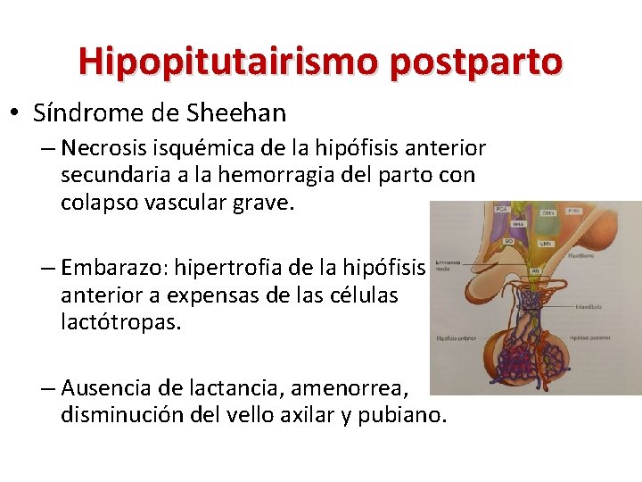 Hipopitutairismo postparto • Síndrome de Sheehan – Necrosis isquémica de la hipófisis anterior secundaria Hipopitutairismo postparto • Síndrome de Sheehan – Necrosis isquémica de la hipófisis anterior secundaria