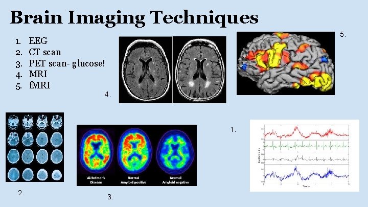 Brain Imaging Techniques 1. 2. 3. 4. 5. EEG CT scan PET scan- glucose!