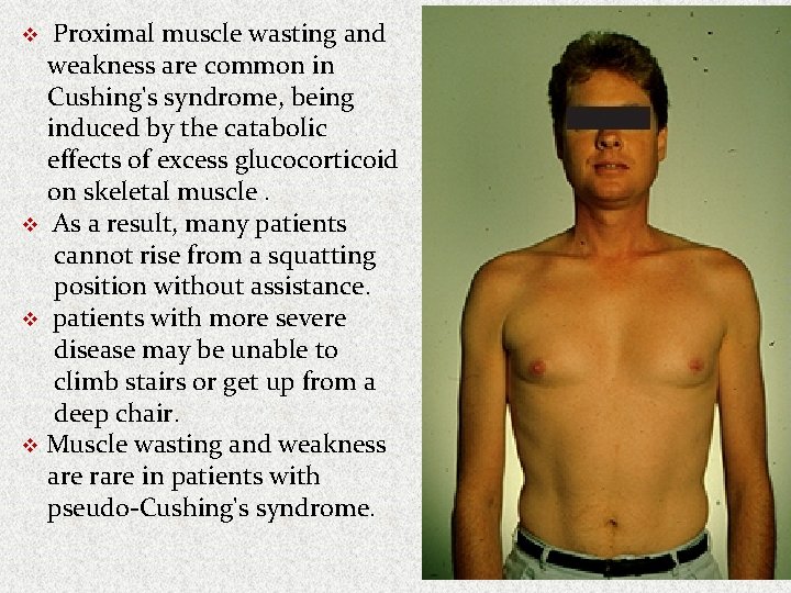 Proximal muscle wasting and weakness are common in Cushing's syndrome, being induced by the