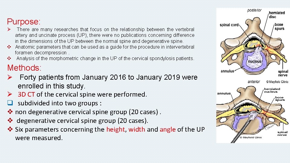 Purpose: Ø There are many researches that focus on the relationship between the vertebral