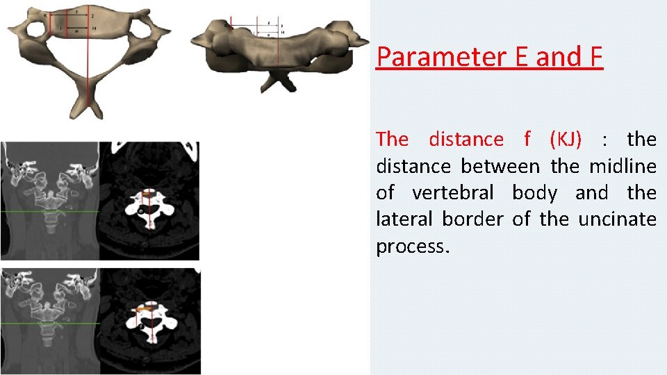 Parameter E and F The distance f (KJ) : the distance between the midline