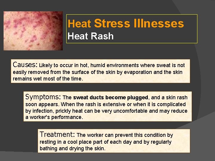 Heat Stress Illnesses Heat Rash Causes: Likely to occur in hot, humid environments where