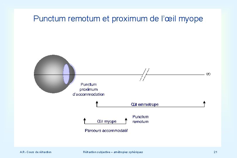 Punctum remotum et proximum de l’œil myope A. R. -Cours de réfraction Réfraction subjective