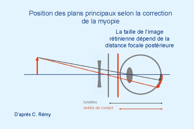 Position des plans principaux selon la correction de la myopie La taille de l’image