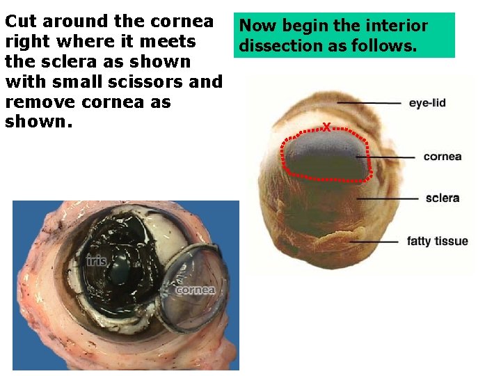 Cut around the cornea Now begin the interior right where it meets dissection as