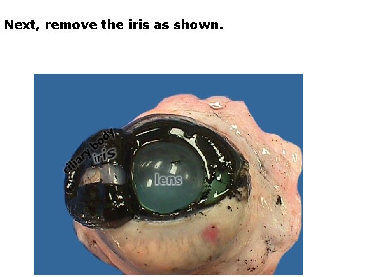 Next, remove the iris as shown. 