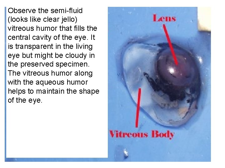 Observe the semi-fluid (looks like clear jello) vitreous humor that fills the central cavity