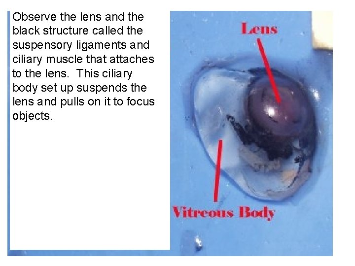 Observe the lens and the black structure called the suspensory ligaments and ciliary muscle