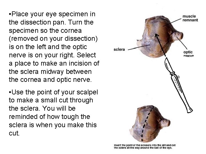  • Place your eye specimen in the dissection pan. Turn the specimen so