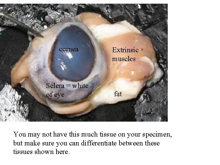 cornea Sclera = white of eye Extrinsic muscles fat You may not have this