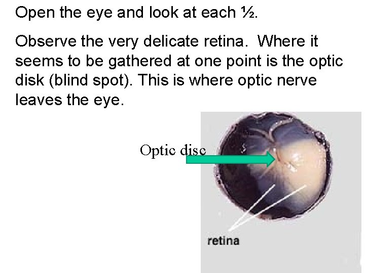 Open the eye and look at each ½. Observe the very delicate retina. Where