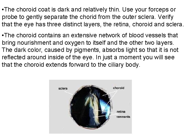  • The choroid coat is dark and relatively thin. Use your forceps or