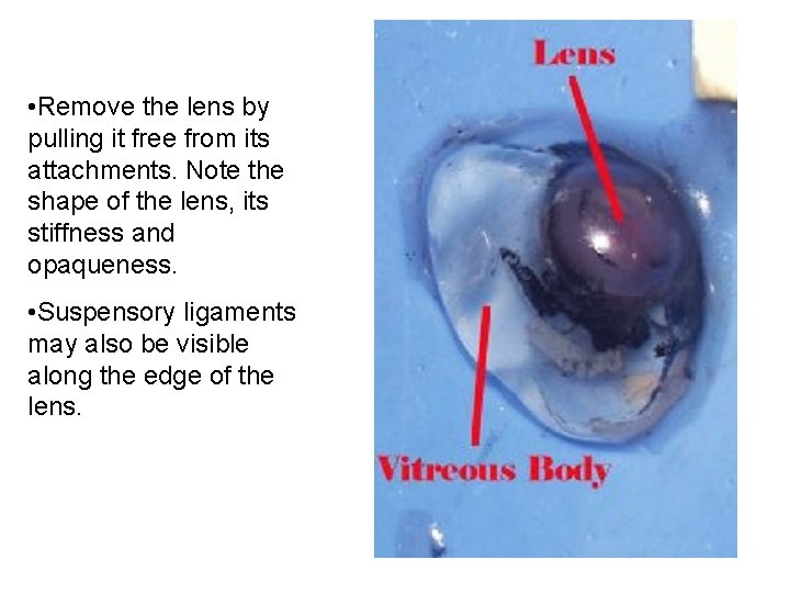  • Remove the lens by pulling it free from its attachments. Note the