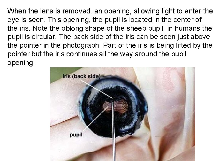 When the lens is removed, an opening, allowing light to enter the eye is