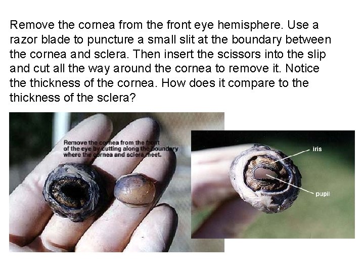 Remove the cornea from the front eye hemisphere. Use a razor blade to puncture