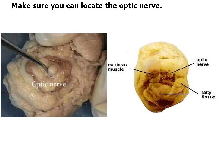 Make sure you can locate the optic nerve. 