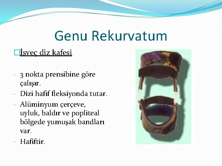 Genu Rekurvatum �İsveç diz kafesi - 3 nokta prensibine göre çalışır. - Dizi hafif Genu Rekurvatum �İsveç diz kafesi - 3 nokta prensibine göre çalışır. - Dizi hafif