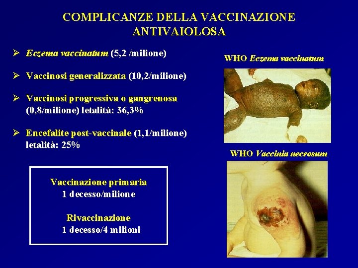 COMPLICANZE DELLA VACCINAZIONE ANTIVAIOLOSA Ø Eczema vaccinatum (5, 2 /milione) WHO Eczema vaccinatum Ø