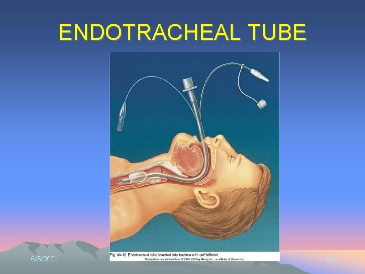 ENDOTRACHEAL TUBE 6/8/2021 64 