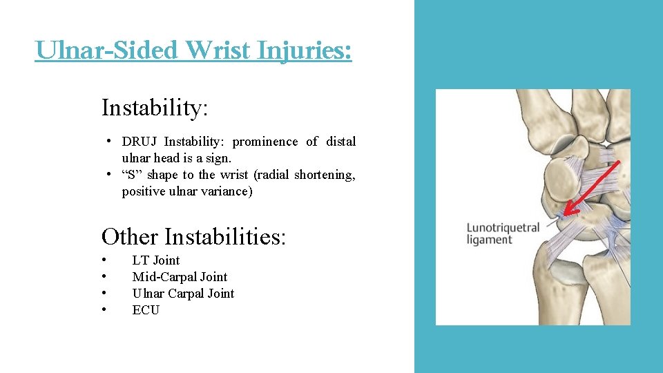 Ulnar-Sided Wrist Injuries: Instability: • DRUJ Instability: prominence of distal ulnar head is a Ulnar-Sided Wrist Injuries: Instability: • DRUJ Instability: prominence of distal ulnar head is a