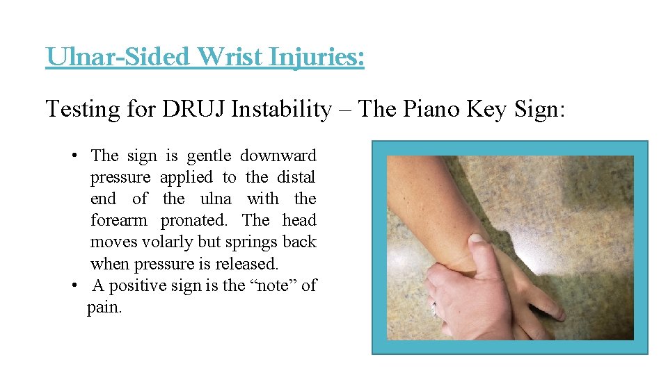Ulnar-Sided Wrist Injuries: Testing for DRUJ Instability – The Piano Key Sign: • The Ulnar-Sided Wrist Injuries: Testing for DRUJ Instability – The Piano Key Sign: • The