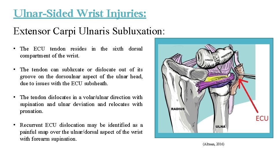 Ulnar-Sided Wrist Injuries: Extensor Carpi Ulnaris Subluxation: • The ECU tendon resides in the Ulnar-Sided Wrist Injuries: Extensor Carpi Ulnaris Subluxation: • The ECU tendon resides in the