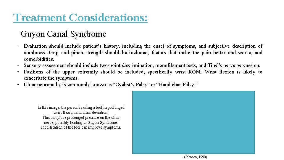 Treatment Considerations: Guyon Canal Syndrome • Evaluation should include patient’s history, including the onset Treatment Considerations: Guyon Canal Syndrome • Evaluation should include patient’s history, including the onset