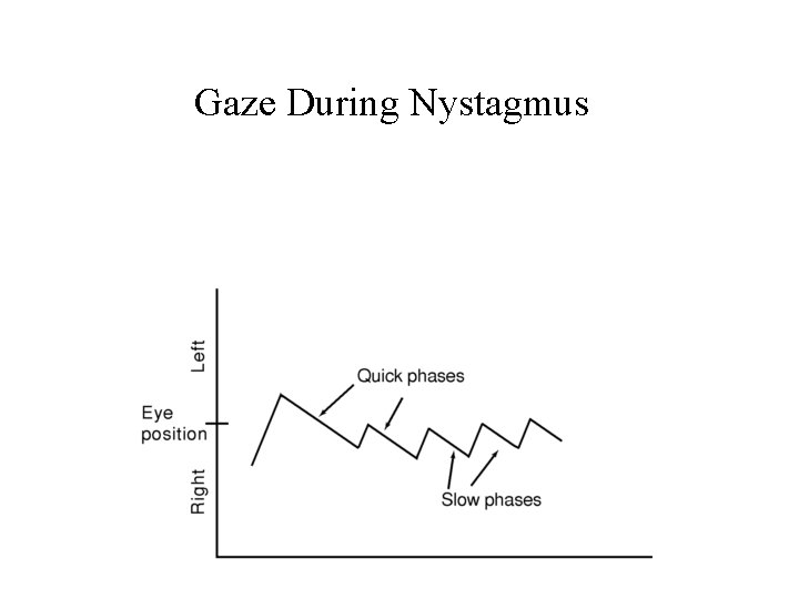 Gaze During Nystagmus 
