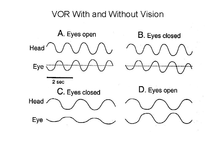 VOR With and Without Vision 
