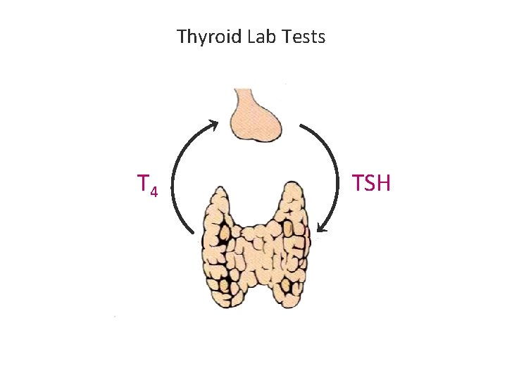 Thyroid Lab Tests T 4 TSH Thyroid Lab Tests T 4 TSH