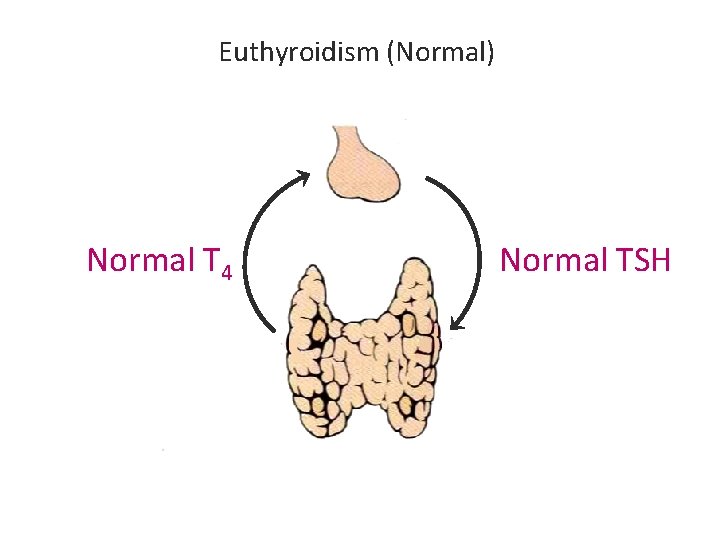 Euthyroidism (Normal) Normal T 4 Normal TSH Euthyroidism (Normal) Normal T 4 Normal TSH