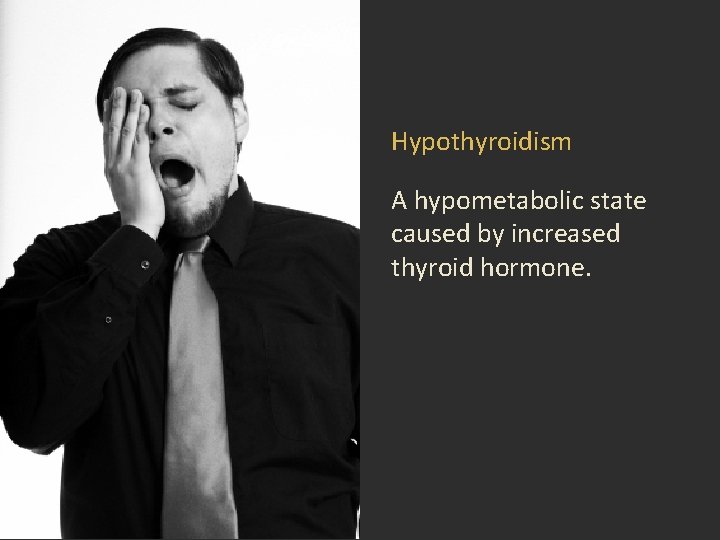 Hypothyroidism A hypometabolic state caused by increased thyroid hormone. Hypothyroidism A hypometabolic state caused by increased thyroid hormone.