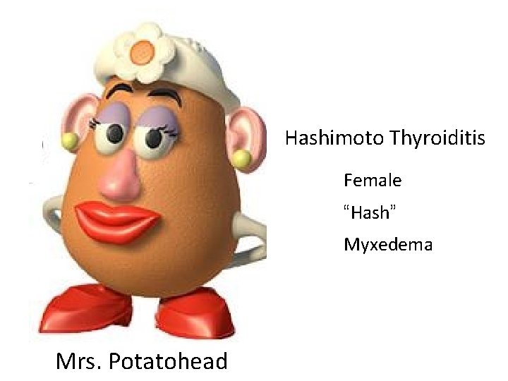Hashimoto Thyroiditis Female “Hash” Myxedema Mrs. Potatohead Hashimoto Thyroiditis Female “Hash” Myxedema Mrs. Potatohead