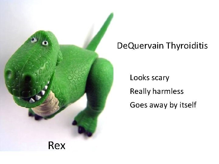 De. Quervain Thyroiditis Looks scary Really harmless Goes away by itself Rex De. Quervain Thyroiditis Looks scary Really harmless Goes away by itself Rex