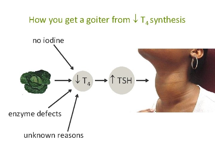How you get a goiter from T 4 synthesis no iodine T 4 enzyme How you get a goiter from T 4 synthesis no iodine T 4 enzyme