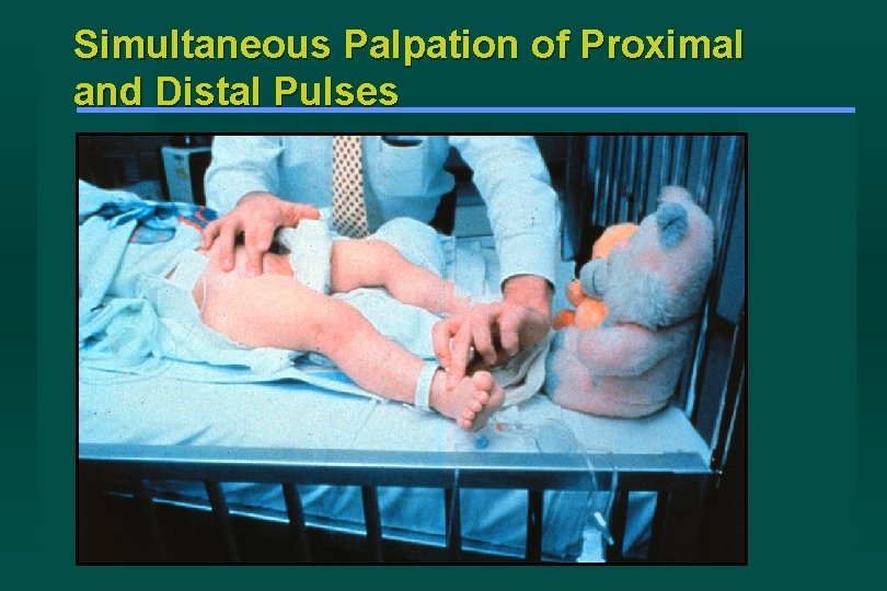 Simultaneous Palpation of Proximal and Distal Pulses 